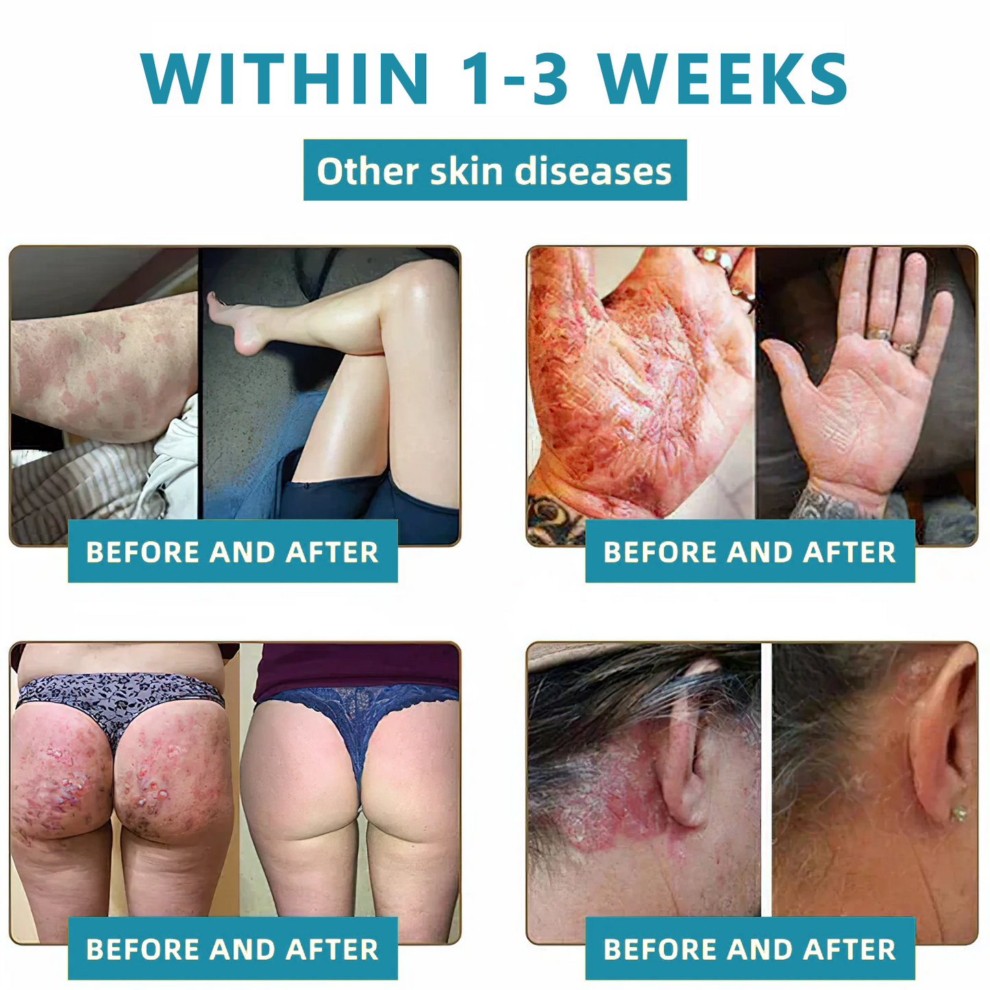 Total Skin Confidence Starts Here💫𝗞ı𝗱s𝗻𝗲𝗲𝗱® 𝗡𝗼𝗻-𝗜𝗻𝘃𝗮𝘀𝗶𝘃𝗲 𝗠𝗼𝗜𝗲 𝗮𝗻𝗱 𝗪𝗮𝗿𝘁 𝗥𝗲𝗺𝗼𝘃𝗮𝗜 𝗜𝗮𝘀𝗲𝗿 𝗣𝗲𝗻👨‍⚕️