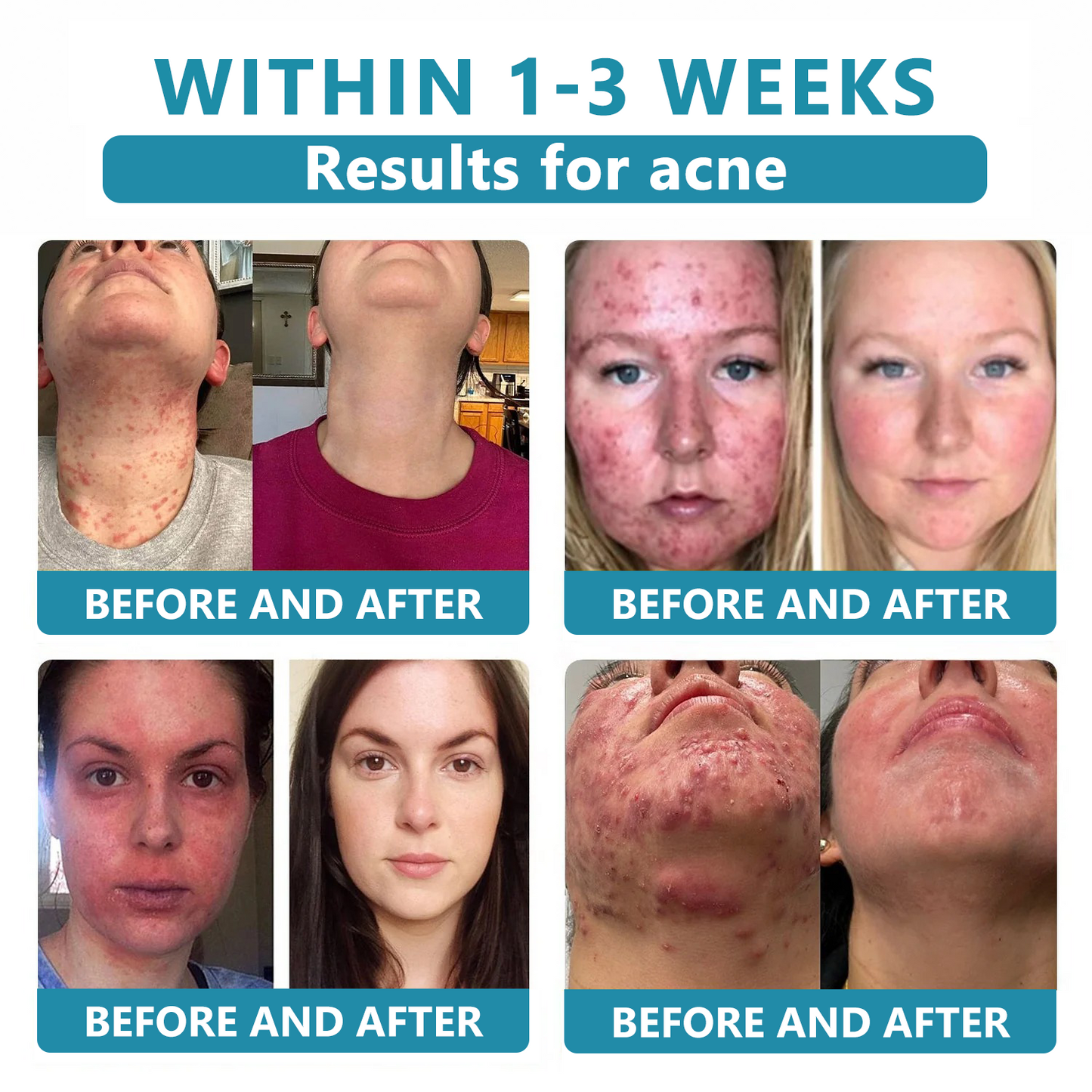 Total Skin Confidence Starts Here✨𝗞ı𝗱s𝗻𝗲𝗲𝗱® 𝗡𝗼𝗻-𝗜𝗻𝘃𝗮𝘀𝗶𝘃𝗲 𝗠𝗼𝗜𝗲 𝗮𝗻𝗱 𝗪𝗮𝗿𝘁 𝗥𝗲𝗺𝗼𝘃𝗮𝗜 𝗜𝗮𝘀𝗲𝗿 𝗣𝗲𝗻👨‍⚕️