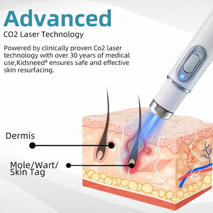 Total Skin Confidence Starts Here💫𝗞ı𝗱s𝗻𝗲𝗲𝗱® 𝗡𝗼𝗻-𝗜𝗻𝘃𝗮𝘀𝗶𝘃𝗲 𝗠𝗼𝗜𝗲 𝗮𝗻𝗱 𝗪𝗮𝗿𝘁 𝗥𝗲𝗺𝗼𝘃𝗮𝗜 𝗜𝗮𝘀𝗲𝗿 𝗣𝗲𝗻👨‍⚕️