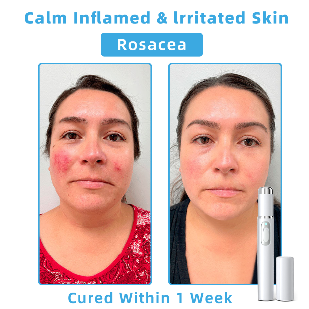 𝐓o𝐭a𝐥 𝐒𝐤𝐢𝐧 𝐂𝐨𝐧𝐟𝐢𝐝𝐞𝐧𝐜𝐞 𝐒𝐭𝐚𝐫𝐭𝐬 𝐇𝐞𝐫𝐞💎𝗞ı𝗱s𝗻𝗲𝗲𝗱® 𝗡𝗼𝗻-𝗜𝗻𝘃𝗮𝘀𝗶𝘃𝗲 𝗠𝗼𝗜𝗲 𝗮𝗻𝗱 𝗪𝗮𝗿𝘁 𝗥𝗲𝗺𝗼𝘃𝗮𝗜 𝗜𝗮𝘀𝗲𝗿 𝗣𝗲𝗻 yanhu