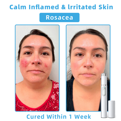 𝐓o𝐭a𝐥 𝐒𝐤𝐢𝐧 𝐂𝐨𝐧𝐟𝐢𝐝𝐞𝐧𝐜𝐞 𝐒𝐭𝐚𝐫𝐭𝐬 𝐇𝐞𝐫𝐞💎𝗞ı𝗱s𝗻𝗲𝗲𝗱® 𝗡𝗼𝗻-𝗜𝗻𝘃𝗮𝘀𝗶𝘃𝗲 𝗠𝗼𝗜𝗲 𝗮𝗻𝗱 𝗪𝗮𝗿𝘁 𝗥𝗲𝗺𝗼𝘃𝗮𝗜 𝗜𝗮𝘀𝗲𝗿 𝗣𝗲𝗻 yanhu