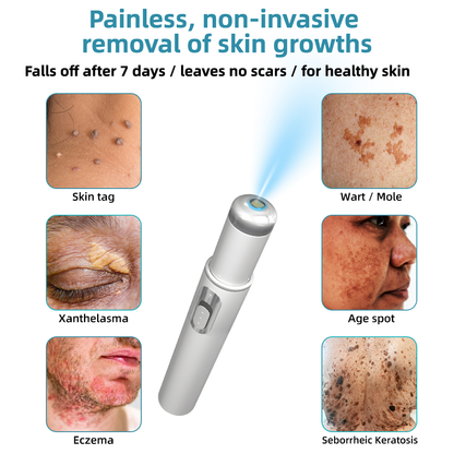 Total Skin Confidence Starts Here💫𝗞ı𝗱s𝗻𝗲𝗲𝗱® 𝗡𝗼𝗻-𝗜𝗻𝘃𝗮𝘀𝗶𝘃𝗲 𝗠𝗼𝗜𝗲 𝗮𝗻𝗱 𝗪𝗮𝗿𝘁 𝗥𝗲𝗺𝗼𝘃𝗮𝗜 𝗜𝗮𝘀𝗲𝗿 𝗣𝗲𝗻👨‍⚕️